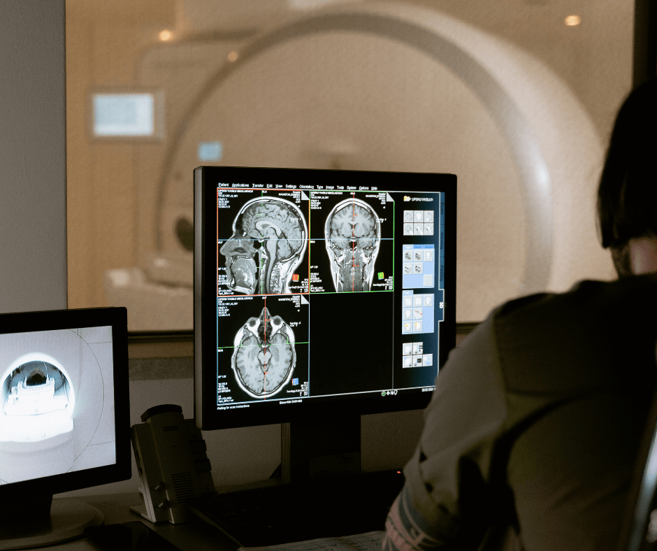 ANEURISMI — RADIOLOGIA INTERVENTISTICA: INNOVATIVO TRATTAMENTO NEUROVASCOLARE AL MATER OLBIAPer la prima volta in Sardegna una tecnologia all’avanguardia per aneurismi cerebrali